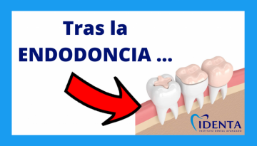 cómo se reconstruye un diente después de una endodoncia