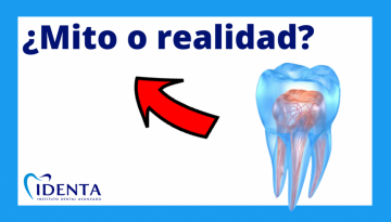 mitos sobre la endodoncia clínica dental identa en chamartín
