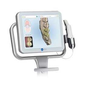 Tu tratamiento 100% digital desde el principio con el escáner intraoral Itero